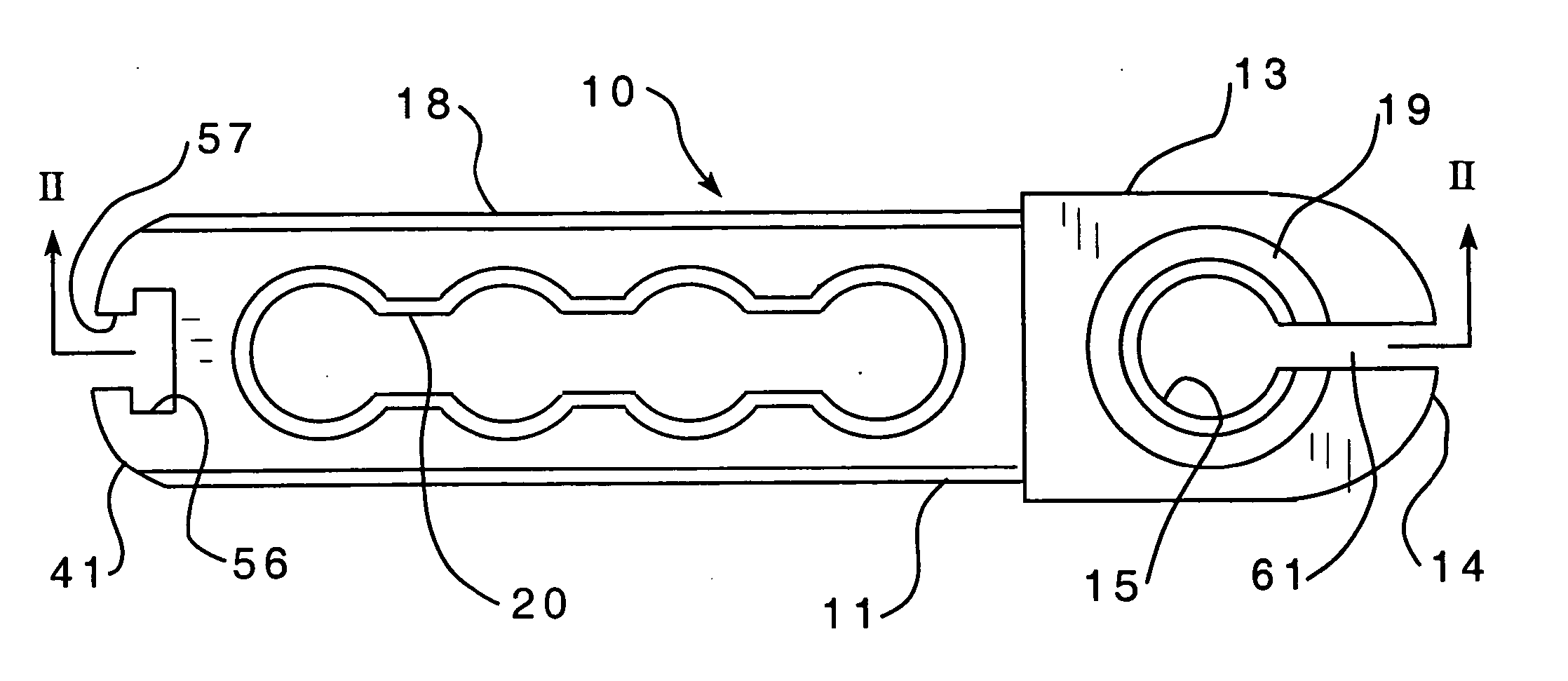 Spinal stabilization implant and method of application