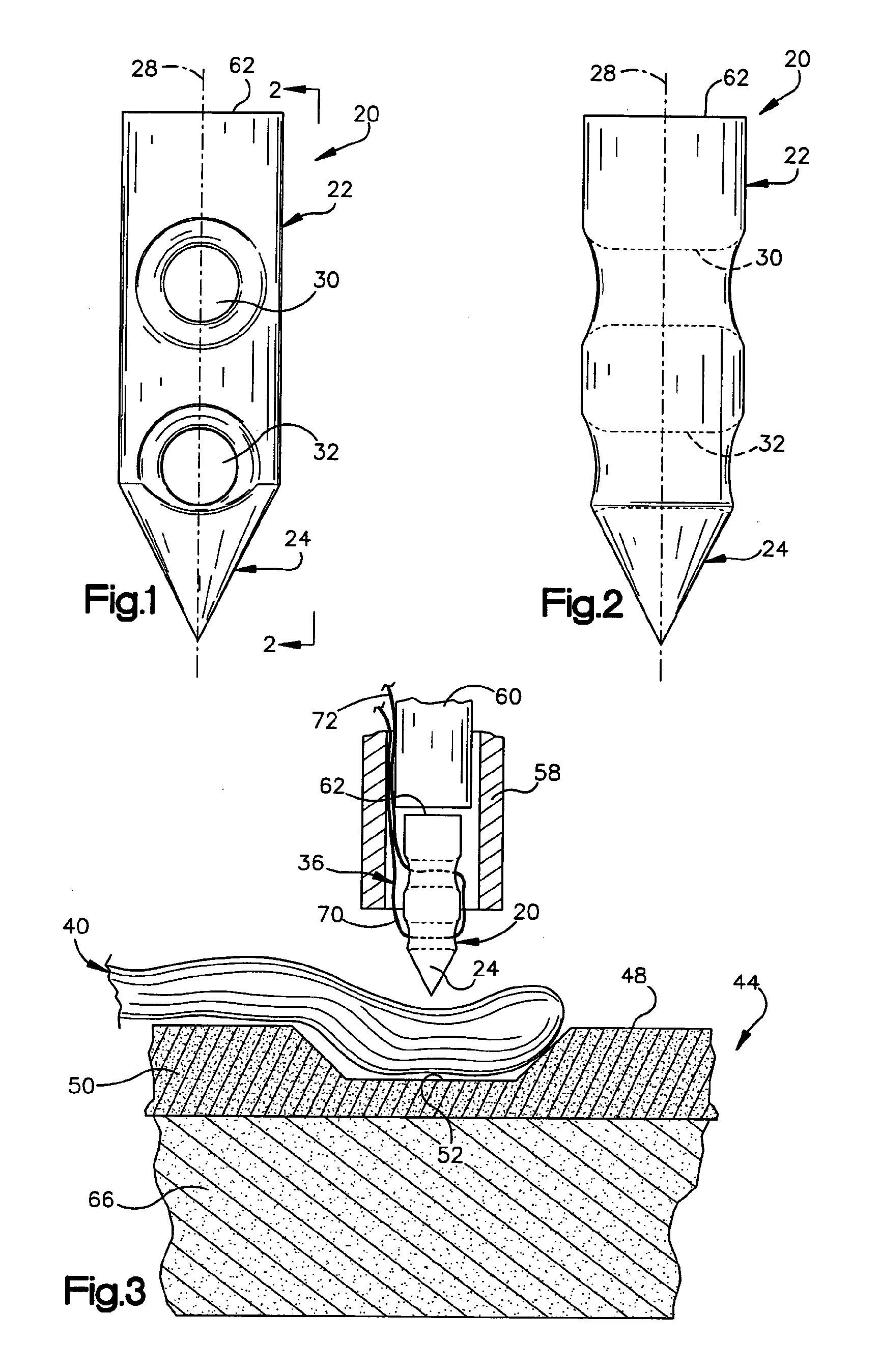 Method and apparatus for securing tissue