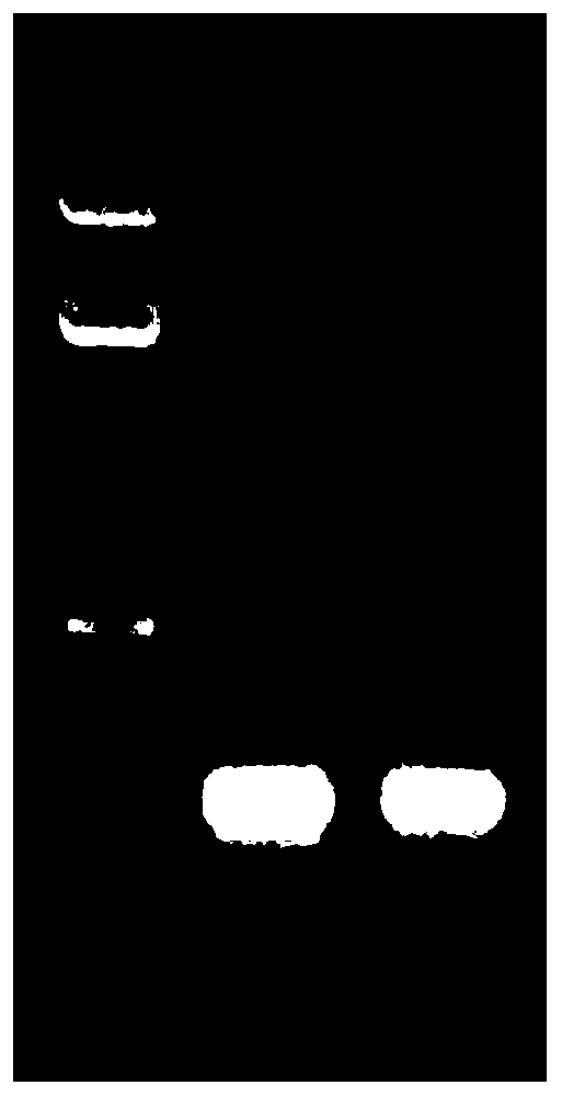 Monoclonal antibody against human neurofilament light polypeptide (NEFL) and application thereof