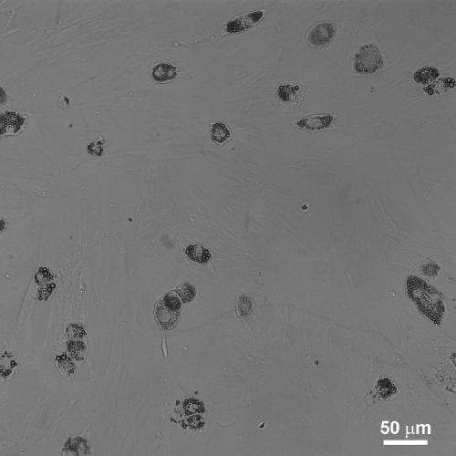 A method for improving the adipogenic differentiation efficiency of bone marrow mesenchymal stem cells