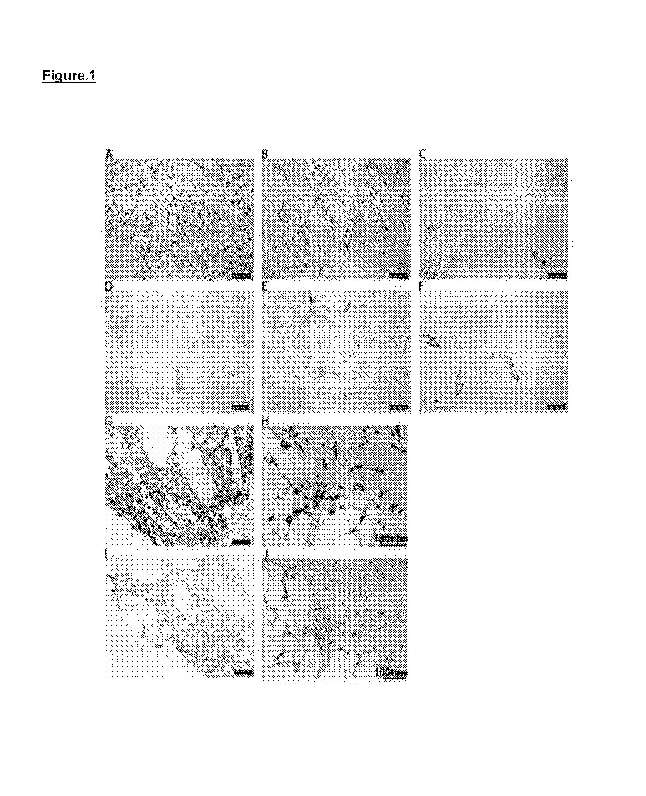 Genetic variant of cytomegalovirus (CMV)