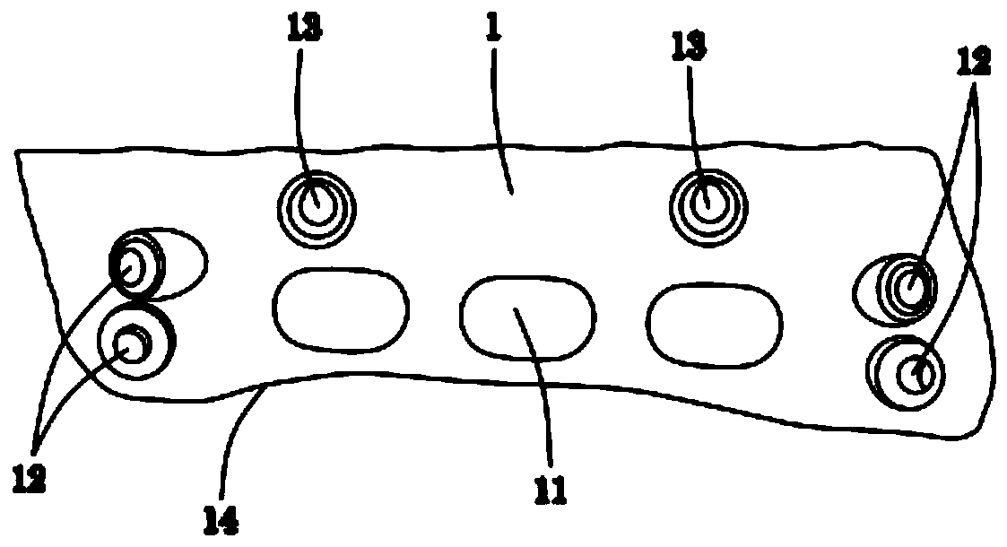 Mandibular reconstruction scaffold