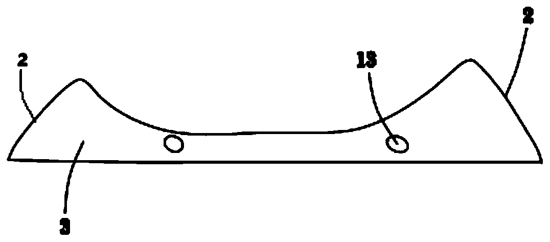 Mandibular reconstruction scaffold