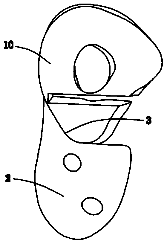 Mandibular reconstruction scaffold