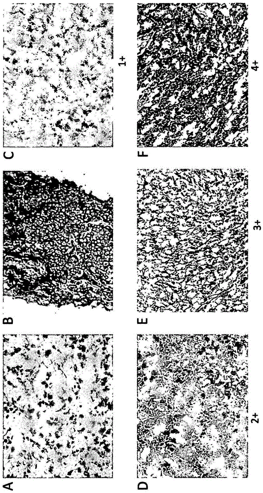 Targeting o-acetylated gd2 ganglioside as a new therapeutic and diagnostic strategy for cancer stem cells cancer