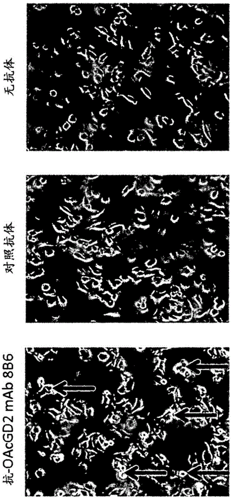 Targeting o-acetylated gd2 ganglioside as a new therapeutic and diagnostic strategy for cancer stem cells cancer