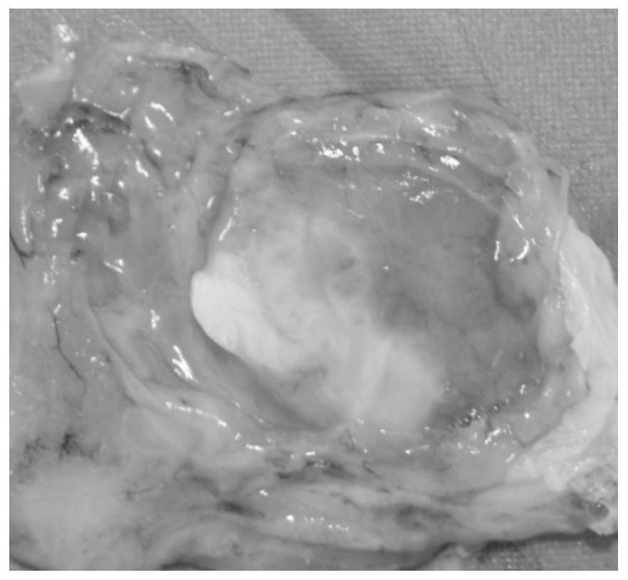 Bone repair material, preparation method thereof and cranio-maxillofacial repair prosthesis