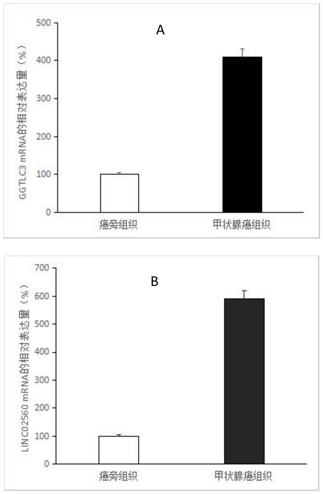 Thyroid cancer related markers and their application