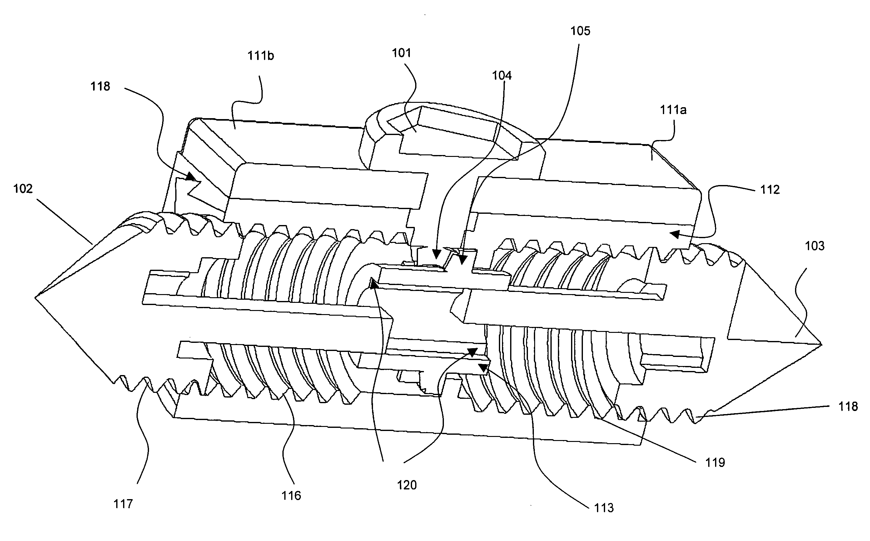 Bi-directional fixating transvertebral body screws, zero-profile horizontal intervertebral miniplates, expansile intervertebral body fusion devices, and posterior motion-calibrating interarticulating joint stapling device for spinal fusion