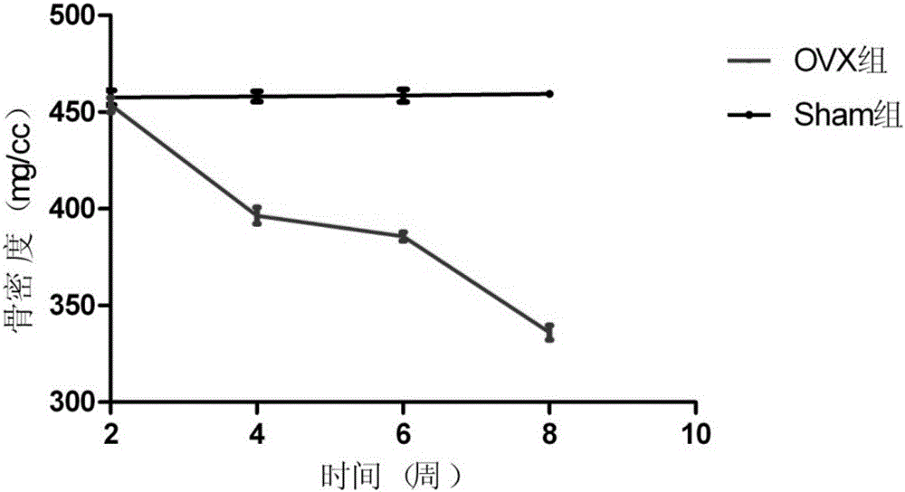 Kit for early prediction of osteoporosis