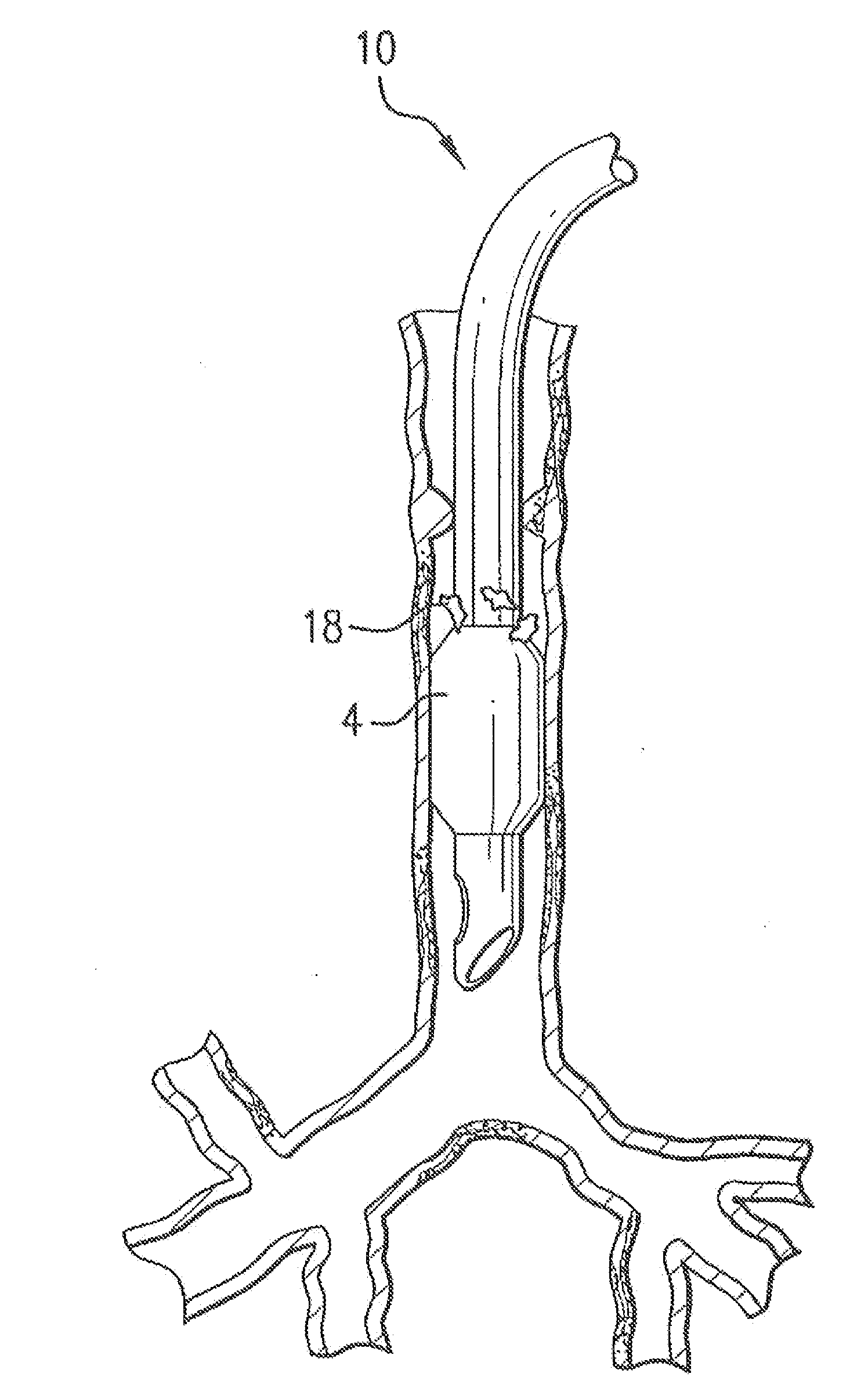 Medical device with antimicrobial layer