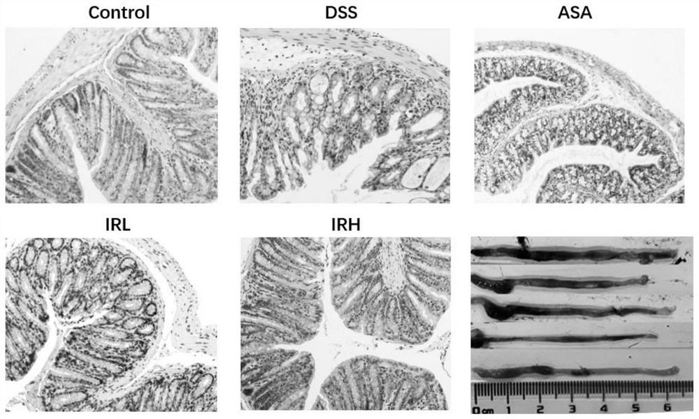 Inula nervosa wall composite extract as well as preparation method and application thereof