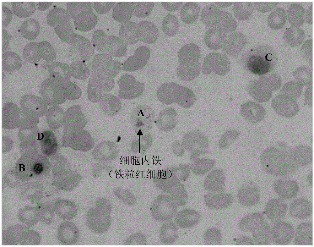 Iron staining (IS) fluid (chemical staining method)