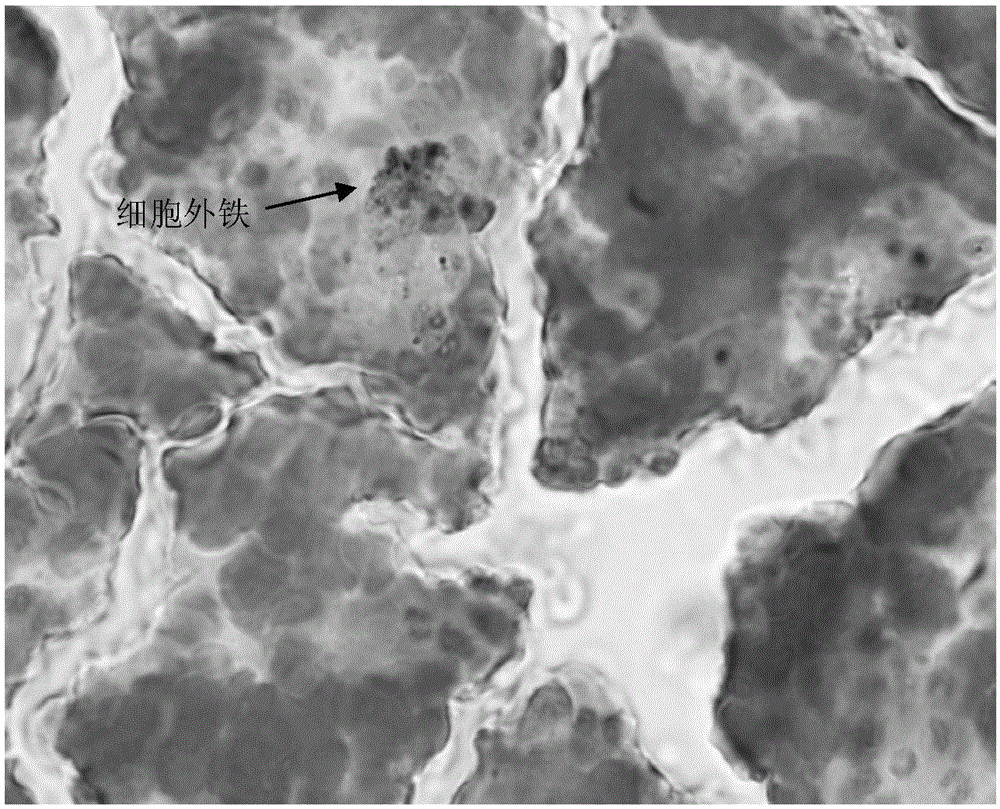 Iron staining (IS) fluid (chemical staining method)