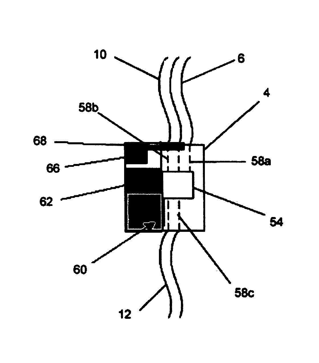 Dialysis implant and methods of use