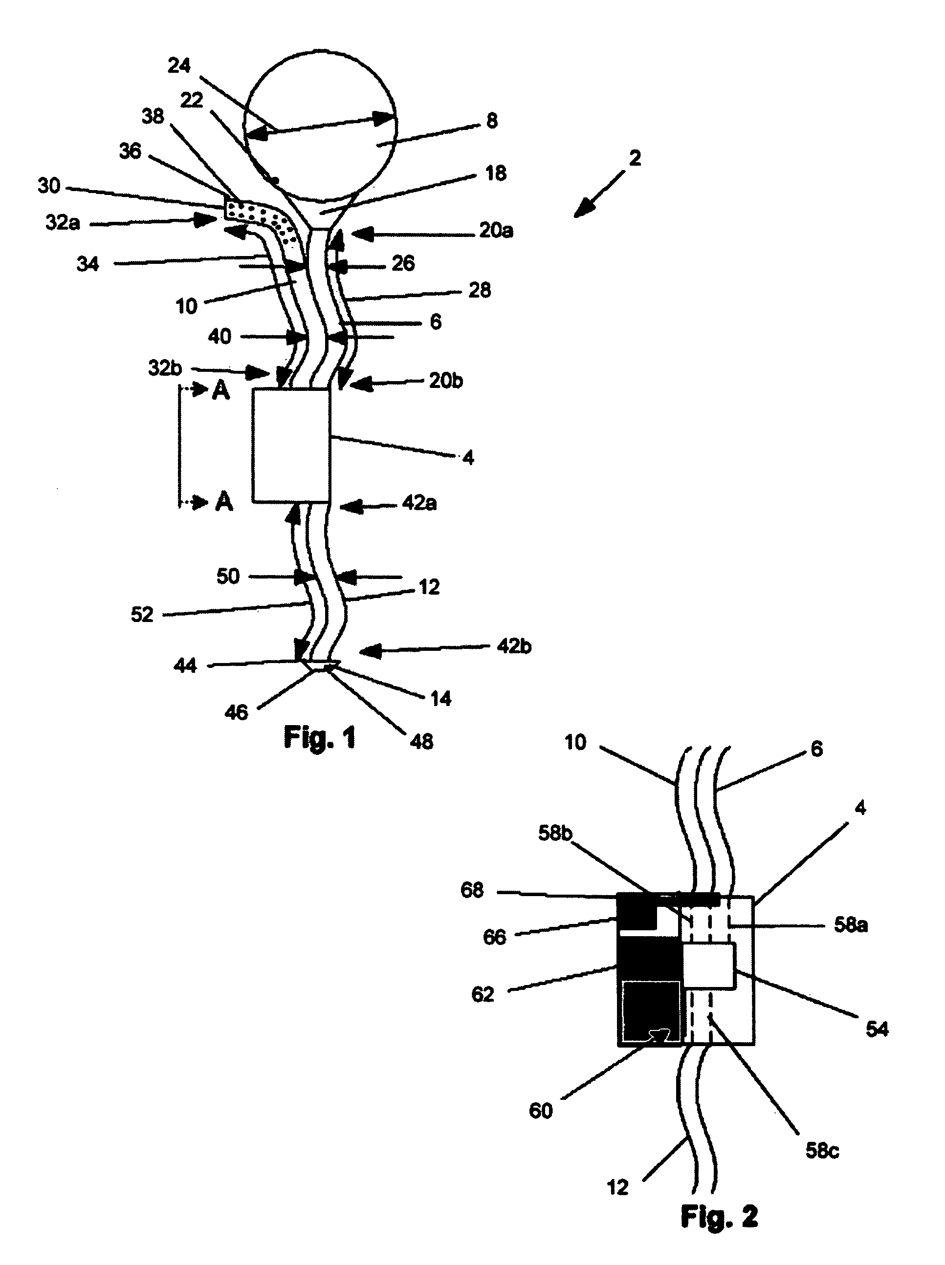 Dialysis implant and methods of use