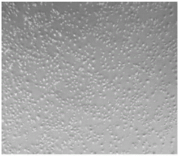 Culture medium and method for inducing differentiation of umbilical cord mesenchymal stem cells to corneal epithelial cells