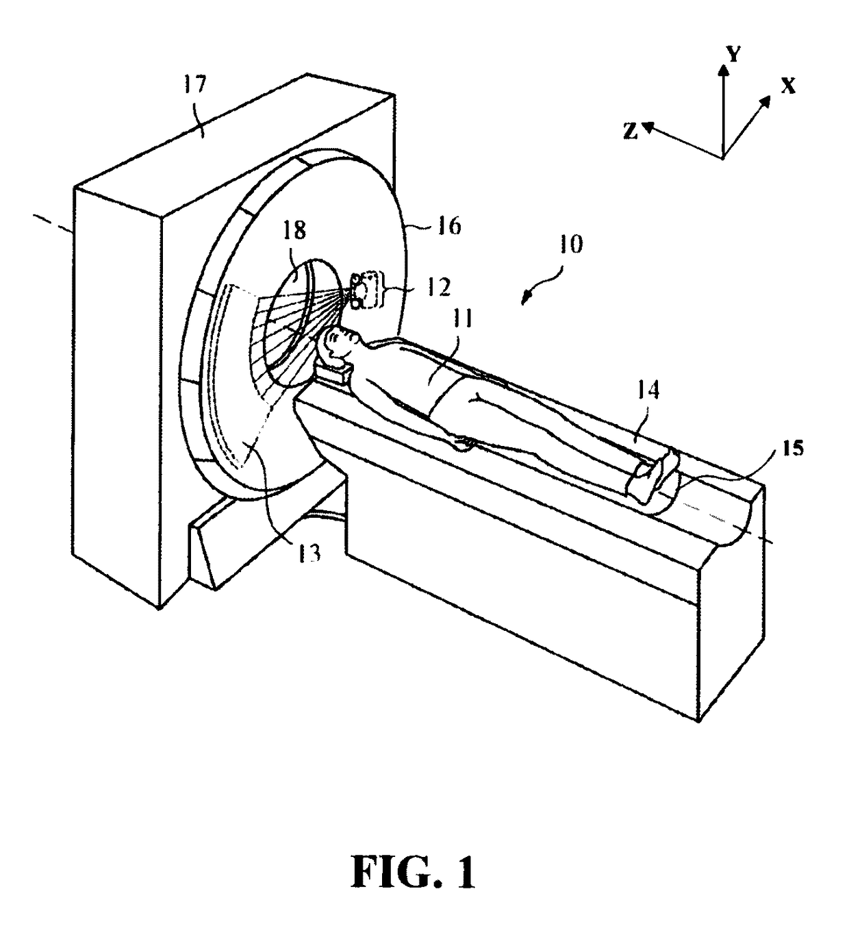 Automatic detection of patient body profile and intelligent positioning of patient