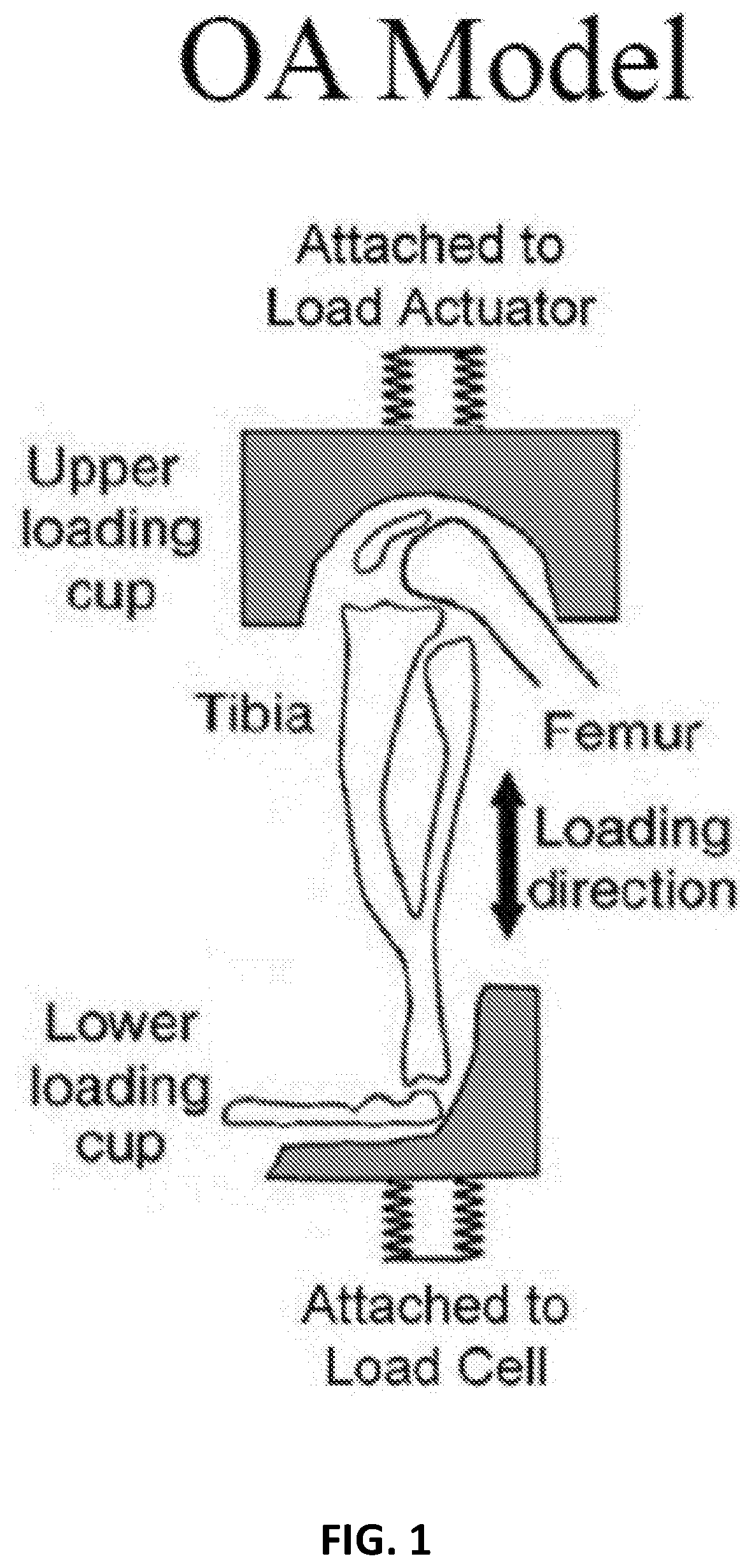 Prevention and Treatment of Osteoarthritis by Inhibition of Insulin Growth Factor-1 Signaling