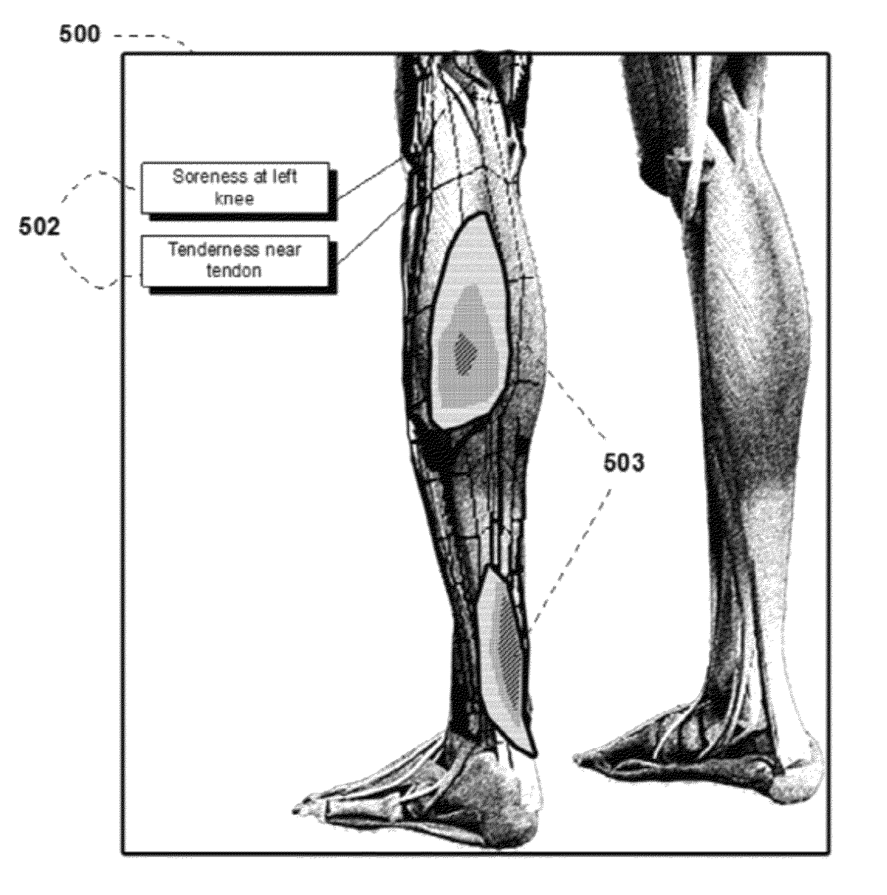 Computer based system and method for medical symptoms analysis, visualization and social network