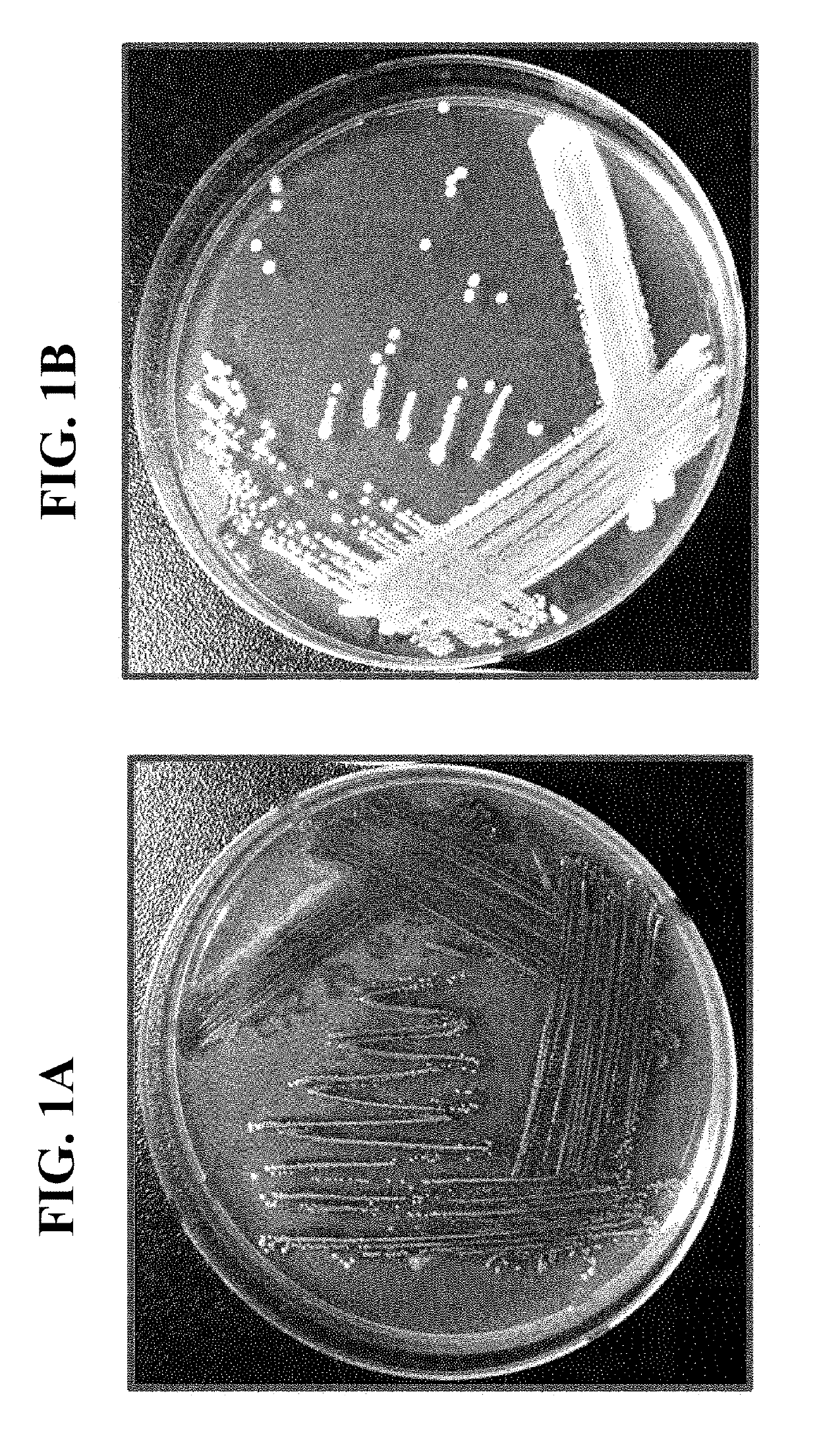 Pharmaceutical composition and healthy food composition with lactobacillus sp. kccm 11826p for preventing or treating hyperphosphatemia in chronic kidney disease