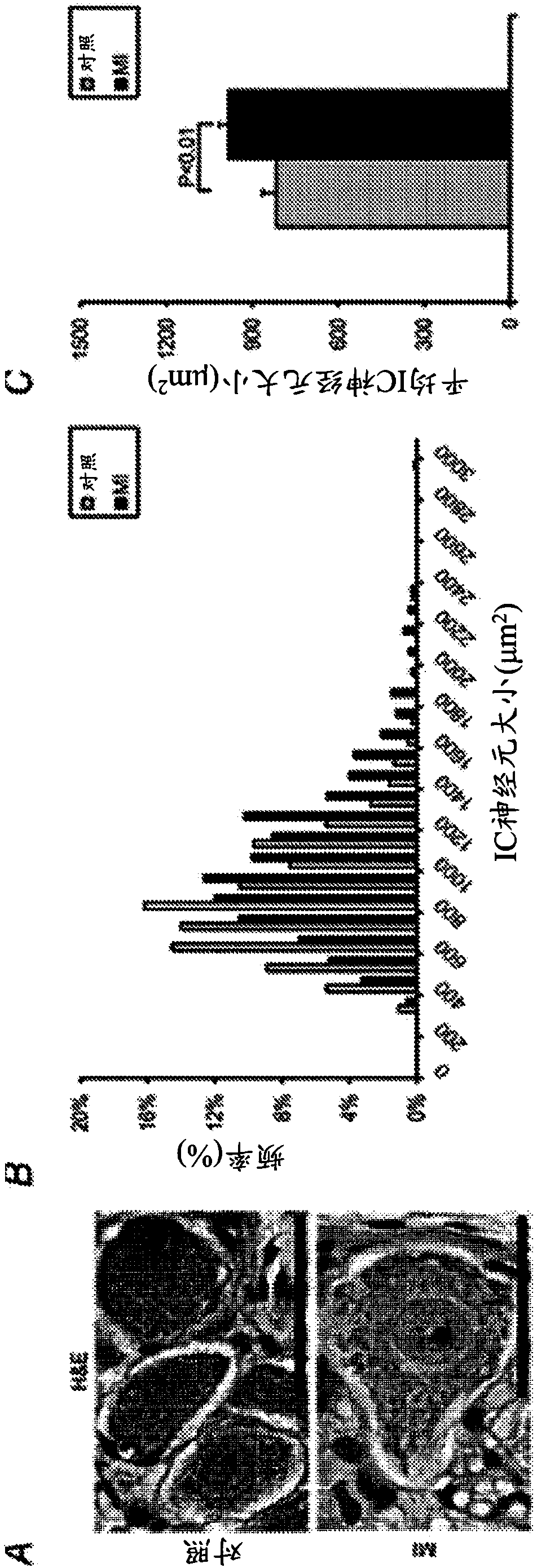 System and method for monitoring and treating arrhythmia and cardiac function via intrinsic cardiac nervous system