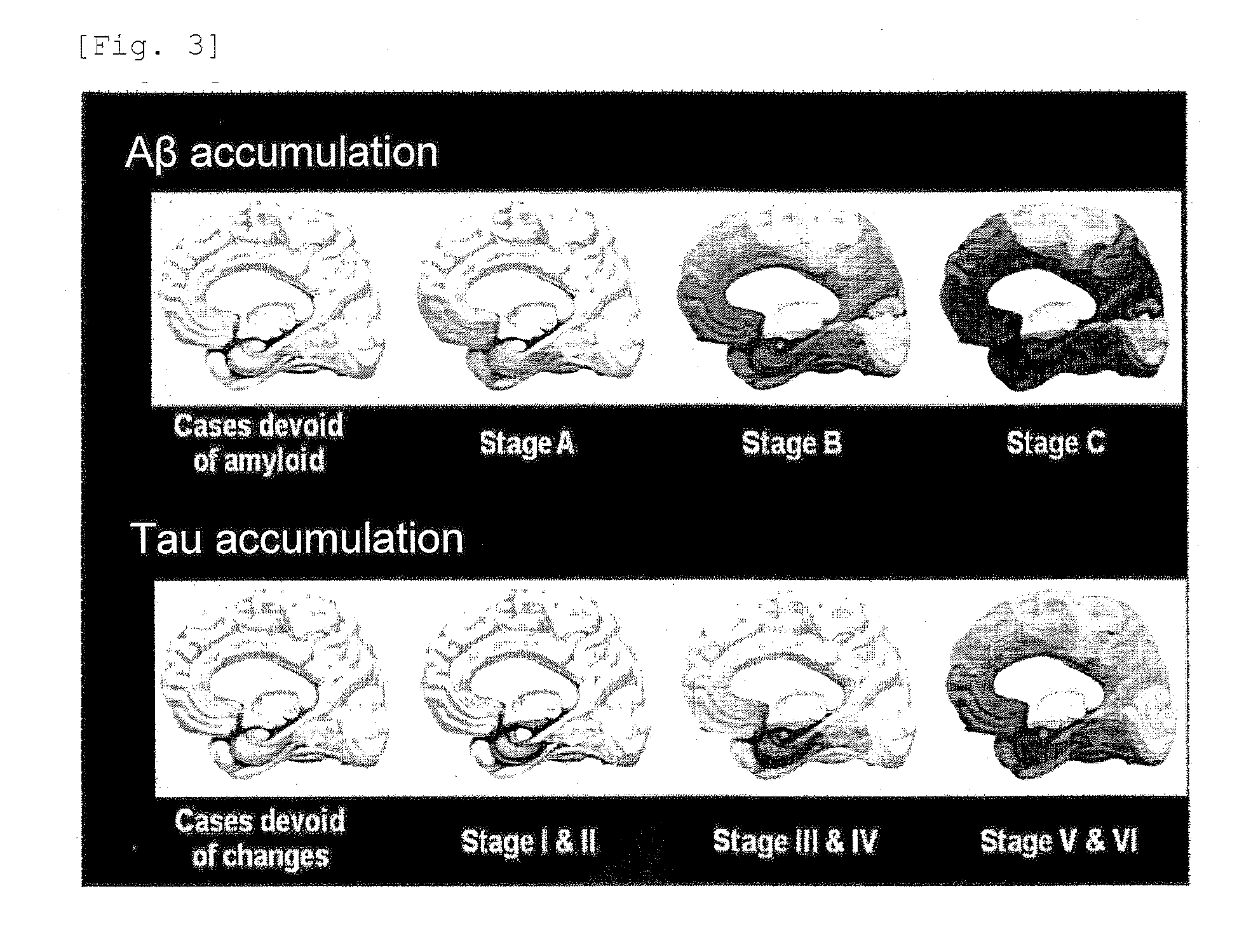 Tau imaging probe