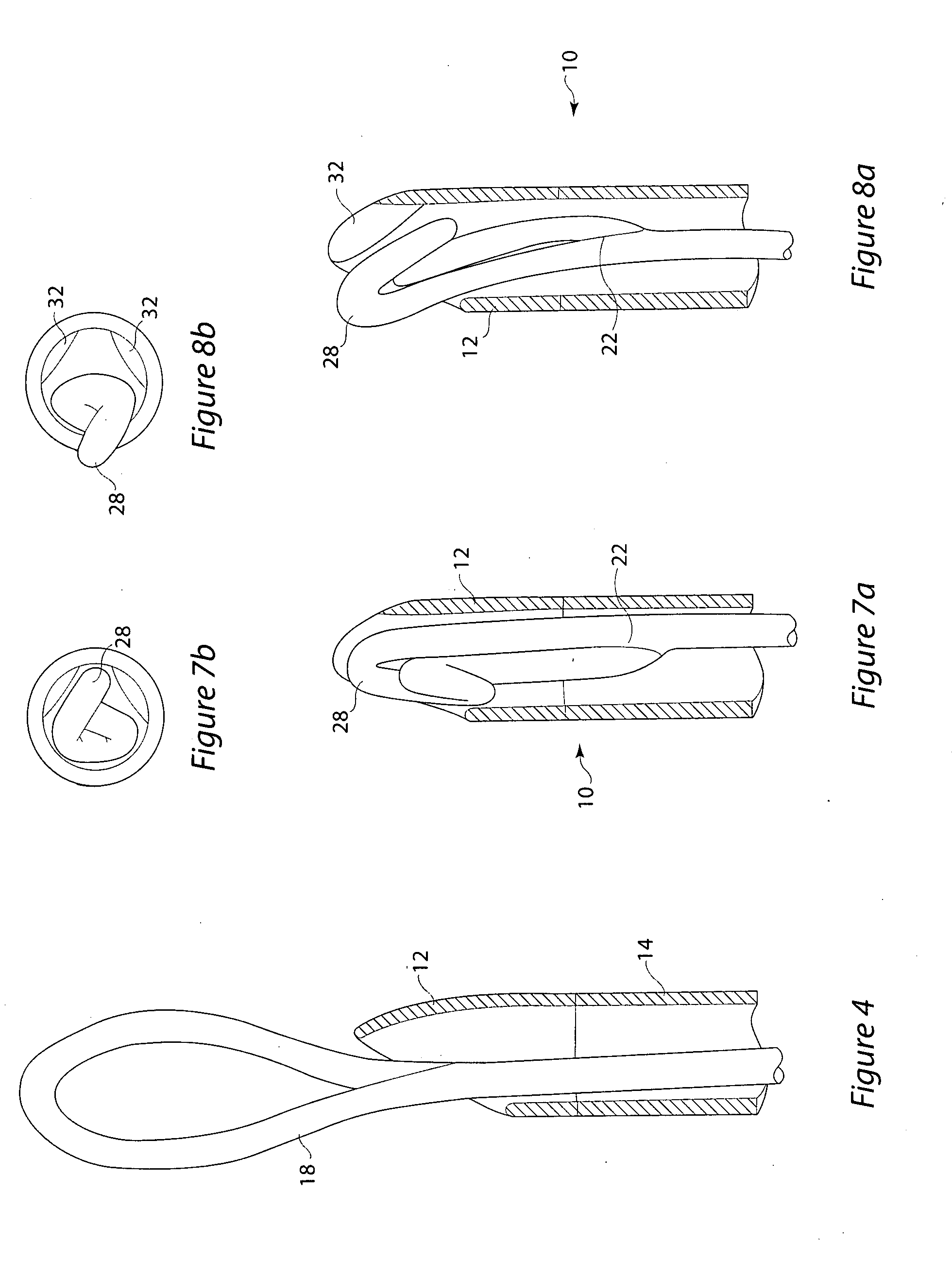 Chronic total occlusion (CTO) removal device