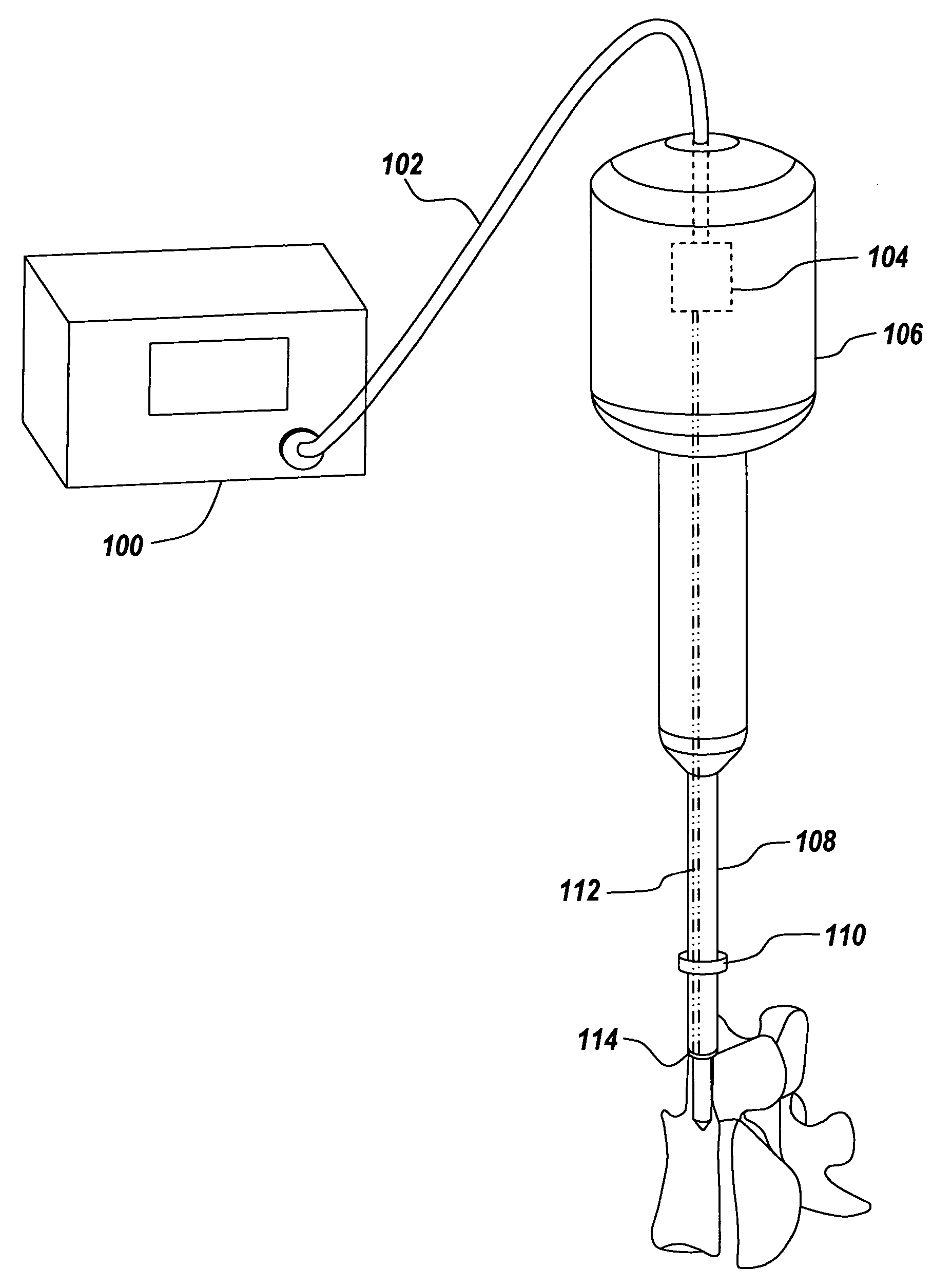 Ultrasonic cutting device