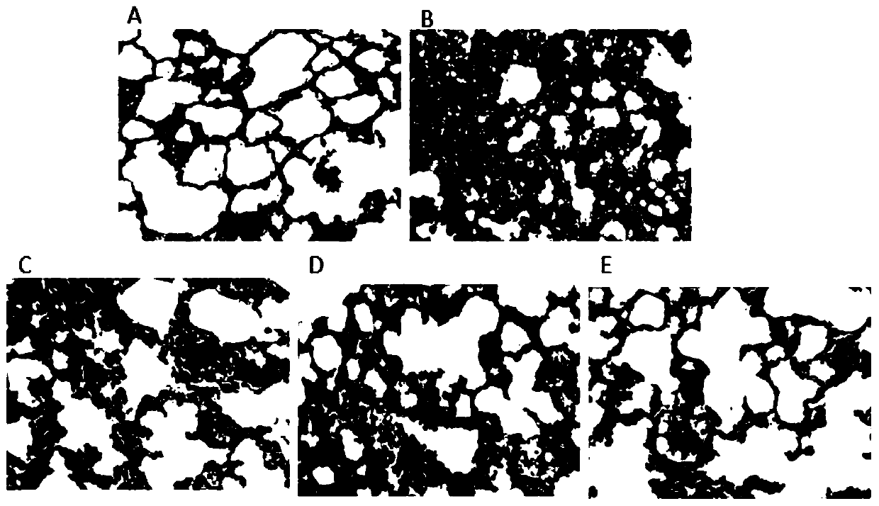 Application of 1,8-dihydroxy-3-methylanthraquinone in preparing medicine for treating acute lung injury