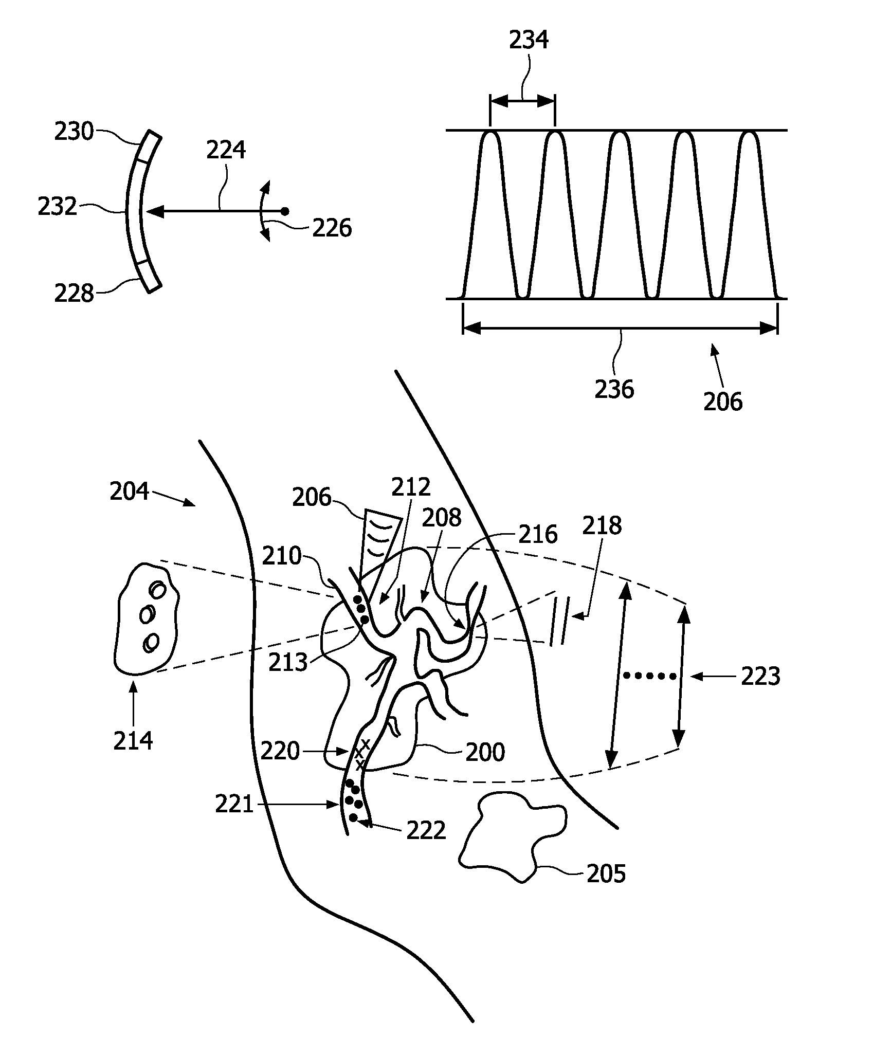 Tumor treatment using ultrasound cavitation