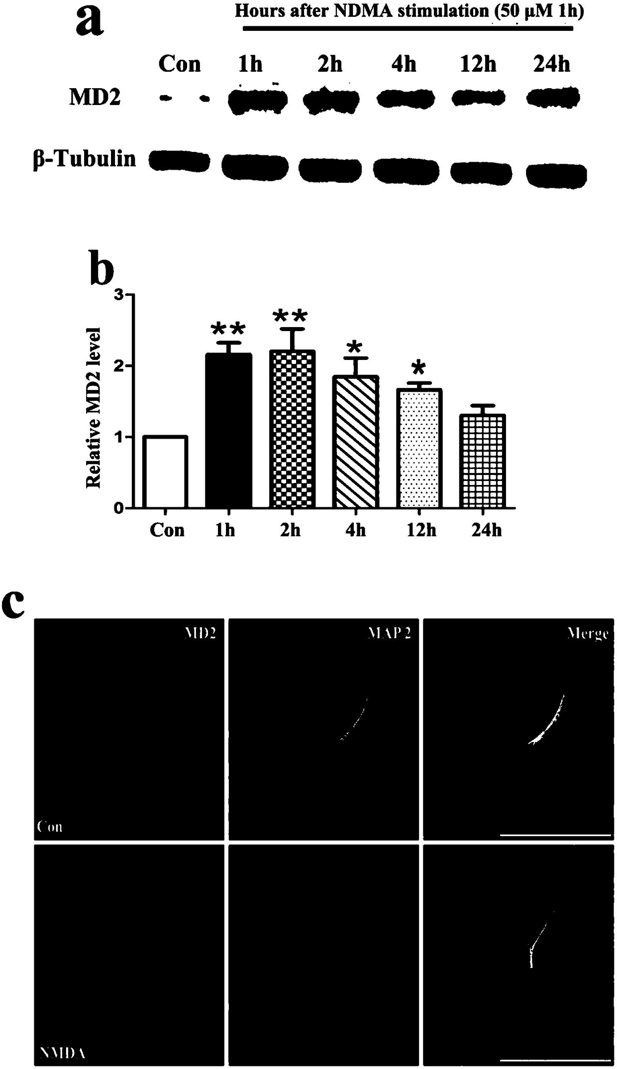 Short chain polypeptide capable of inhibiting binding of MD2 and CIRP protein and application of short chain polypeptide