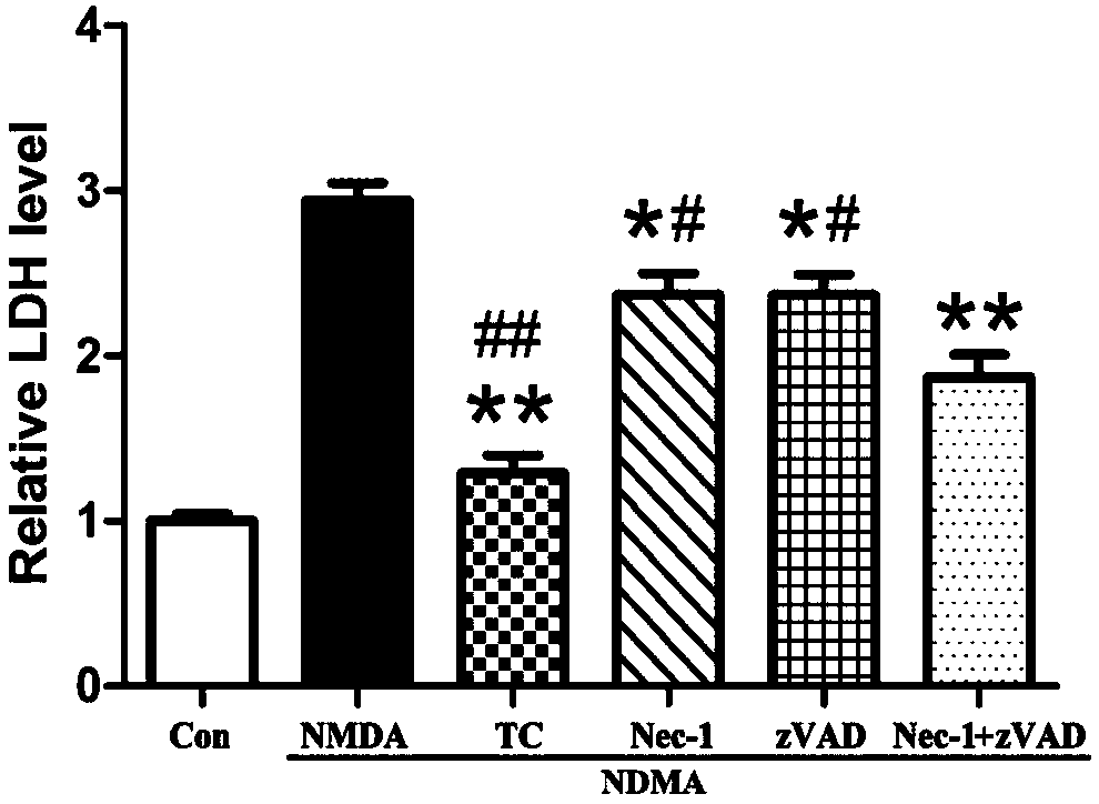 Short chain polypeptide capable of inhibiting binding of MD2 and CIRP protein and application of short chain polypeptide