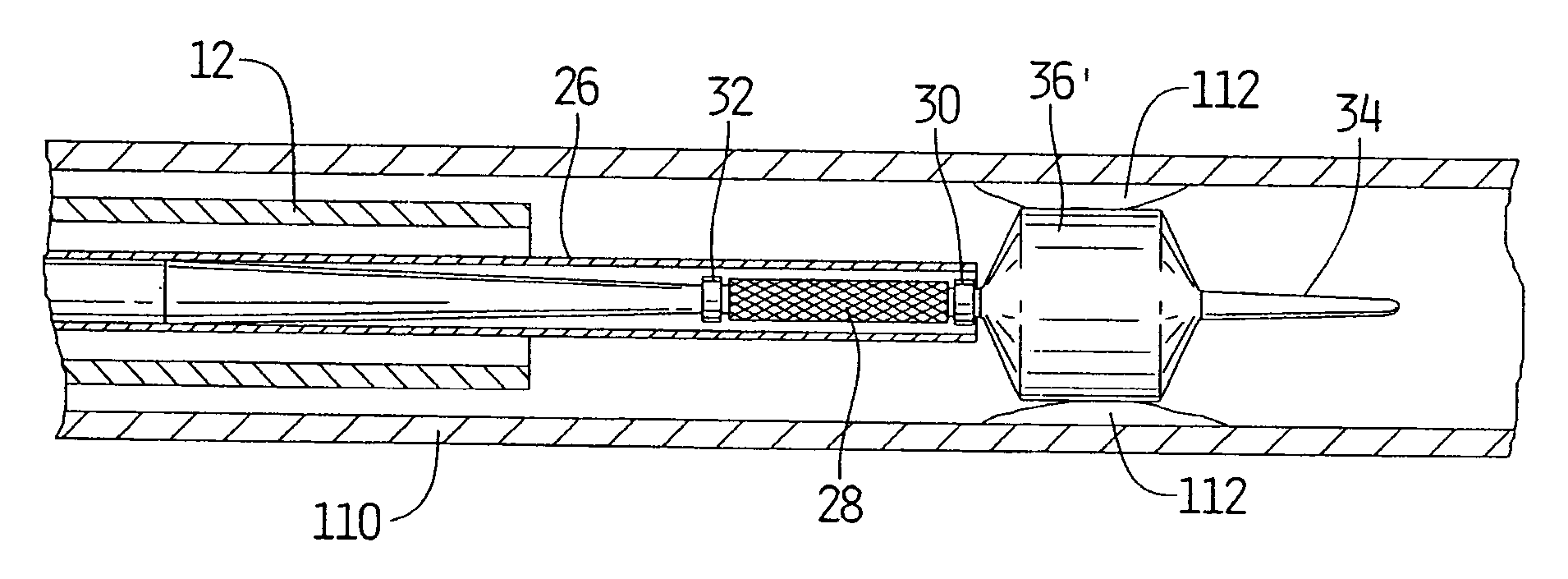 Guidewire loaded stent for delivery through a catheter