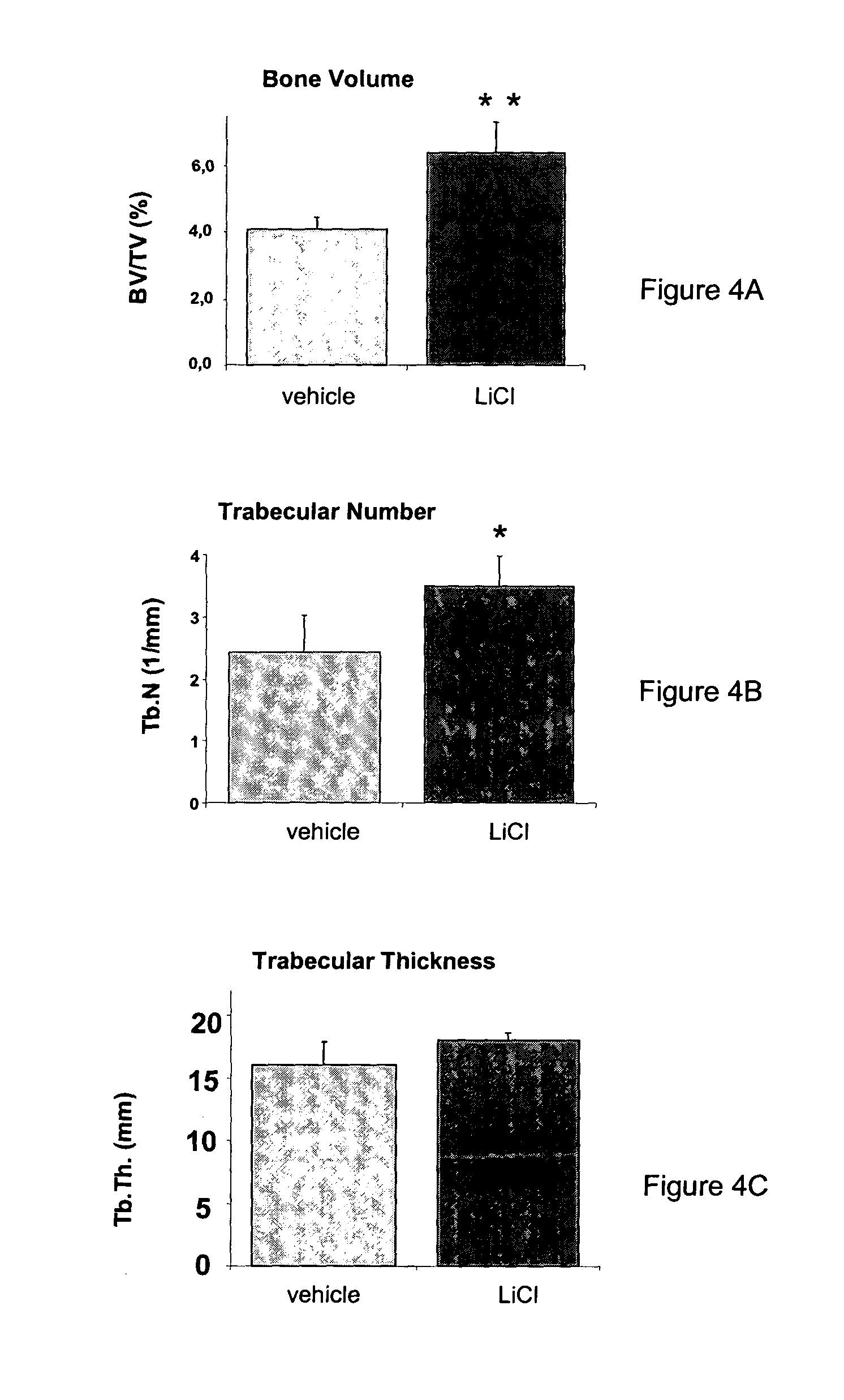 GSK-3beta inhibitors in the treatment of bone-related diseases