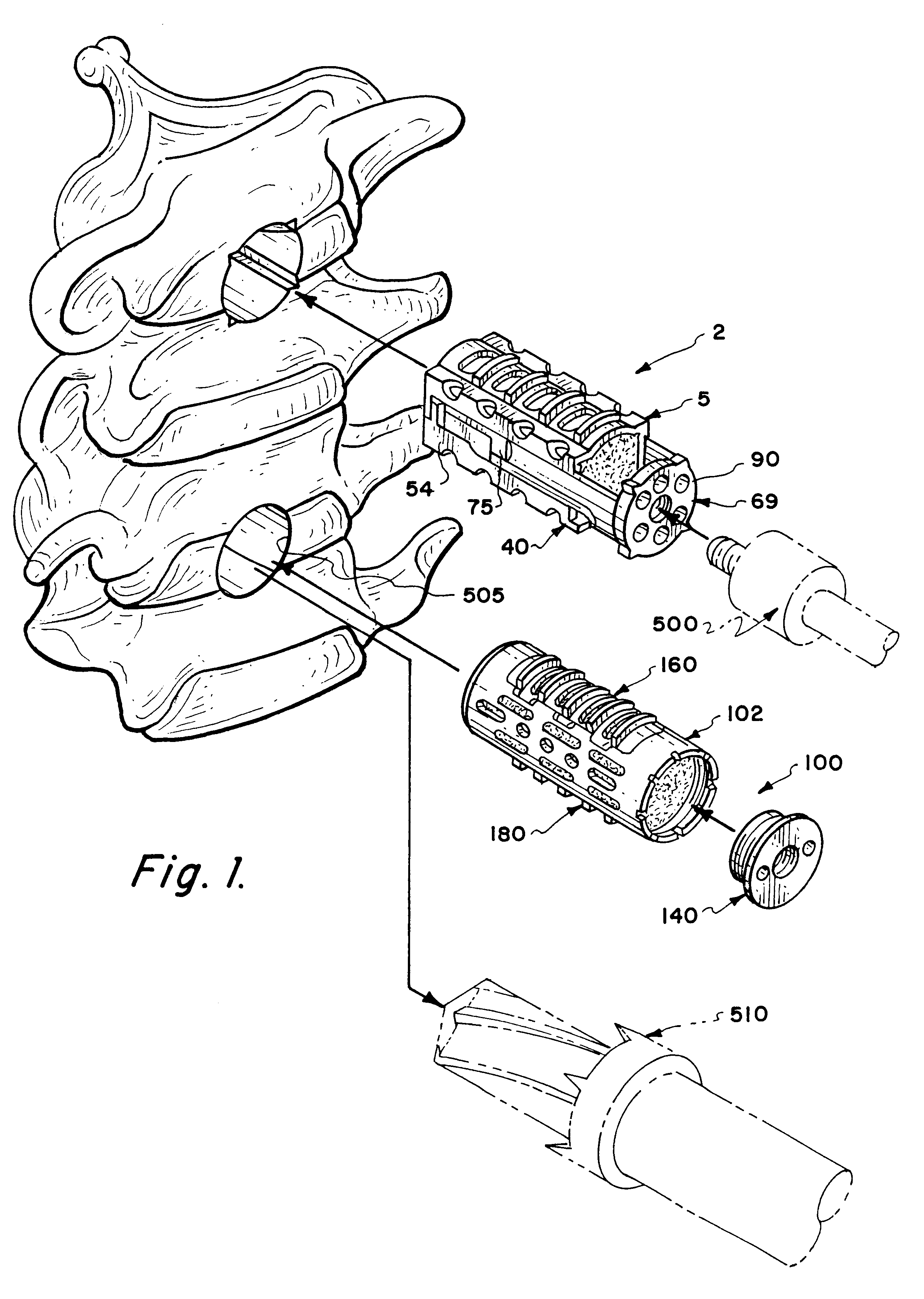 Expandable spinal implants