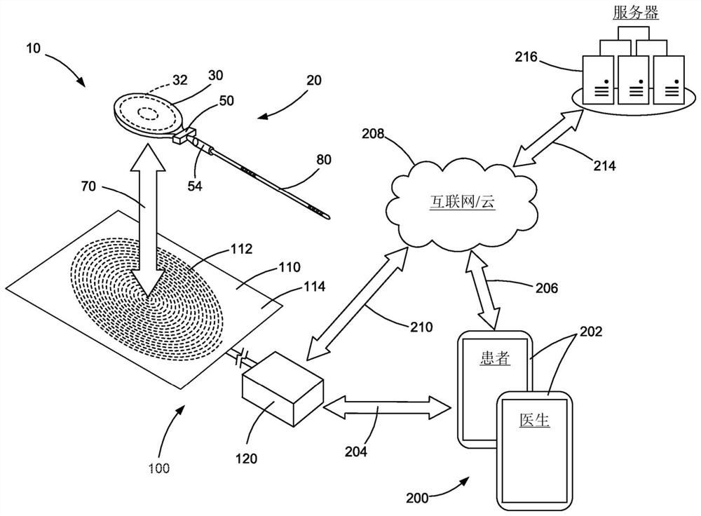 Systems and methods for improving sleep disordered breathing