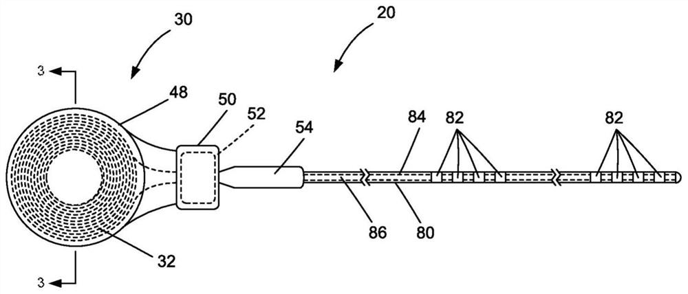 Systems and methods for improving sleep disordered breathing