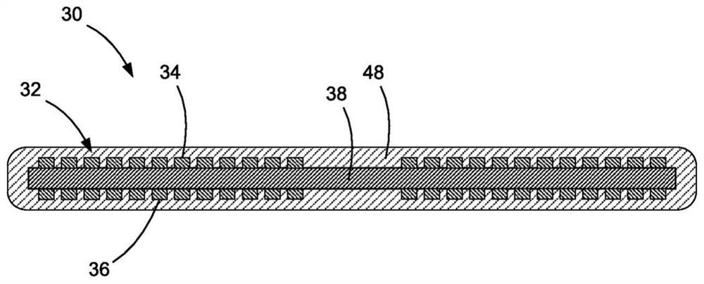 Systems and methods for improving sleep disordered breathing