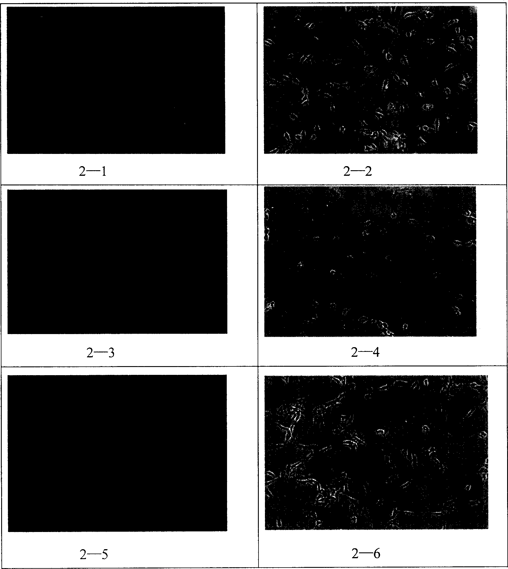 Plasmid containing recombinant immunological toxin MIP-1ª‡-DT390 aiming at activated Th1 cell, its preparation method and uses