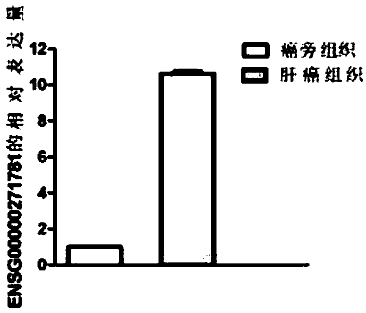 Application of noncoding gene in diagnosis and treatment of liver cancer