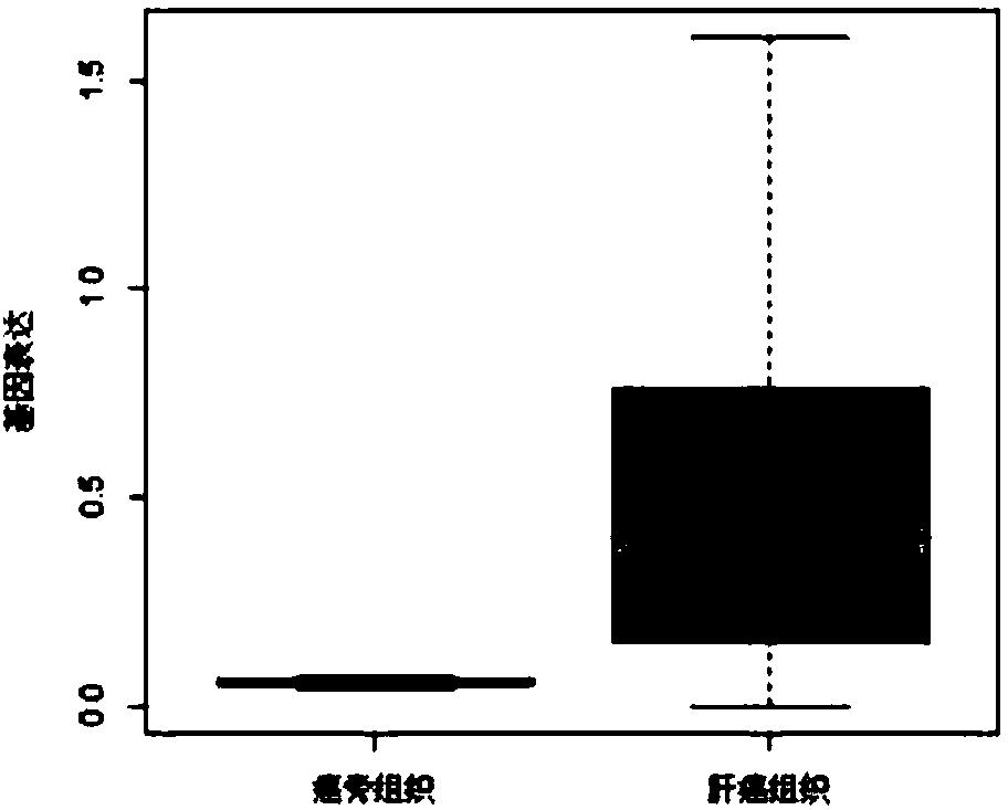 Application of noncoding gene in diagnosis and treatment of liver cancer