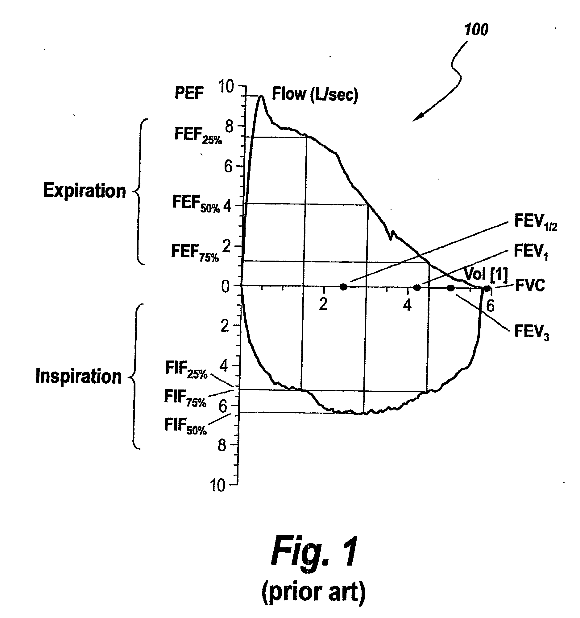 Method and apparatus for intelligent flow sensors