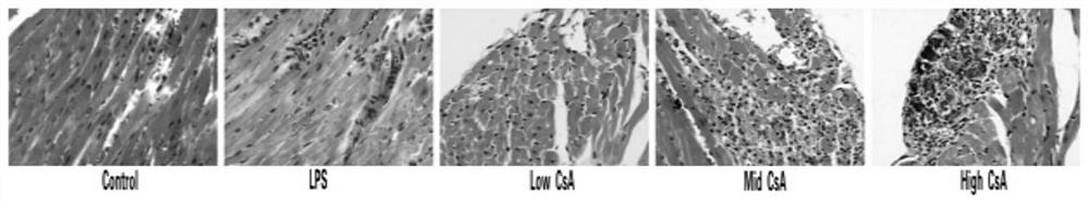 A mouse model of immunosuppressive myocarditis and its construction method and application