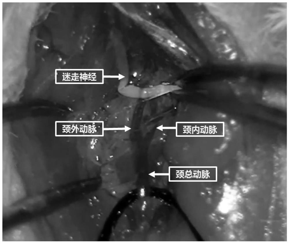 Construction method of novel brain metastatic tumor animal model