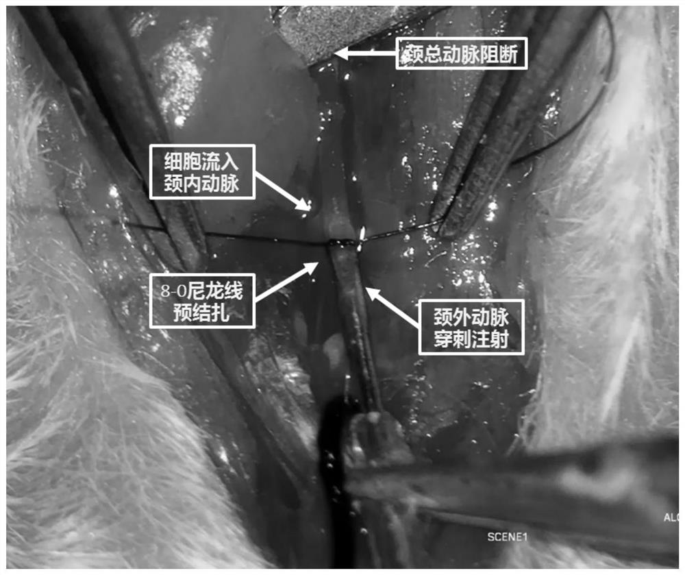 Construction method of novel brain metastatic tumor animal model