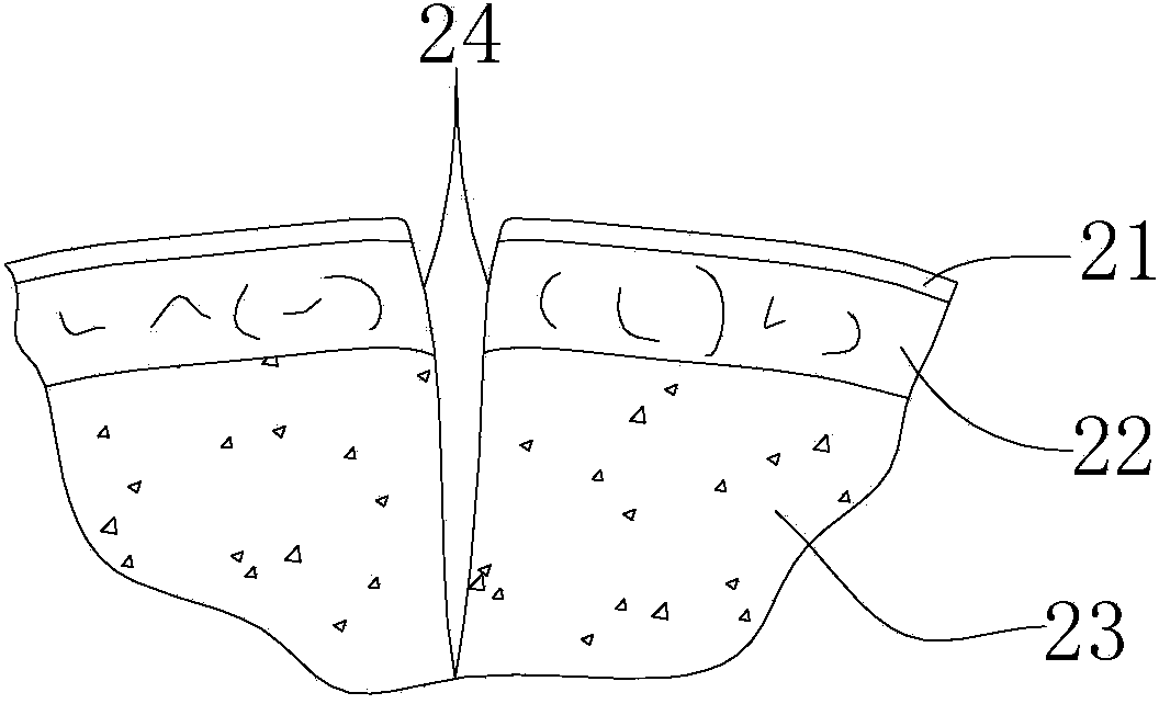 Absorbable skin suture nail