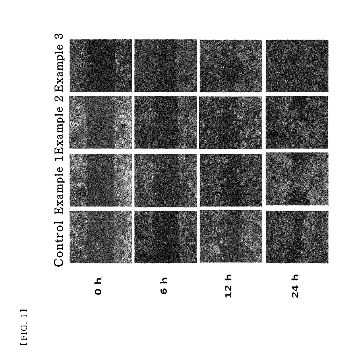 Pharmaceutical composition for treating or preventing corneal wound comprising thymosin β4 and citric acid