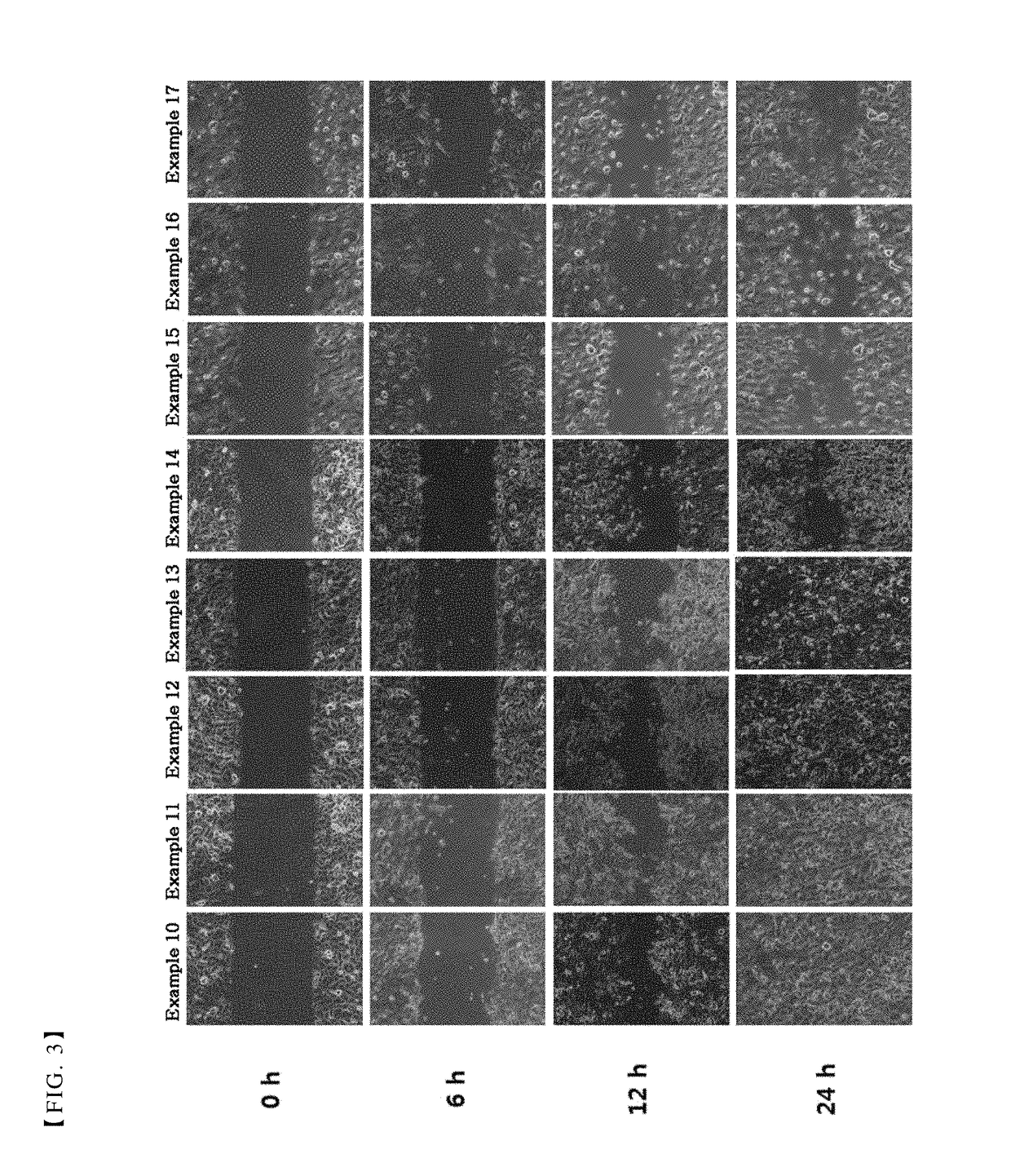 Pharmaceutical composition for treating or preventing corneal wound comprising thymosin β4 and citric acid