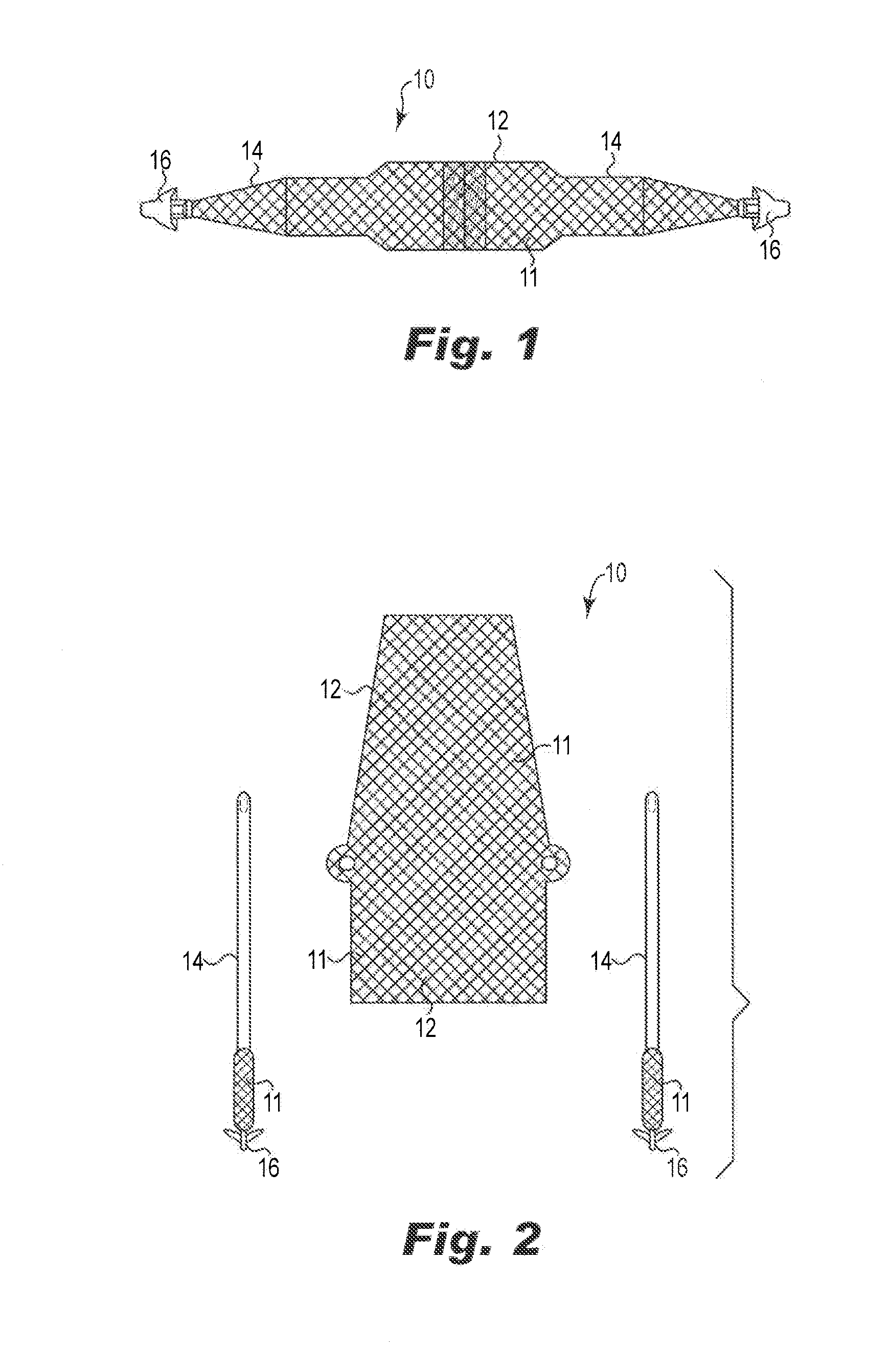 Implantable Slings and Anchor Systems